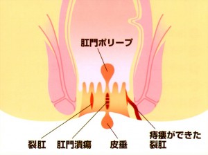 肛門外科 北村医院