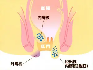 肛門外科 北村医院