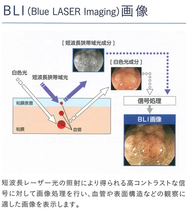 胃内視鏡検査 北村医院