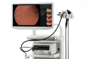 胃内視鏡検査（胃カメラ） | 北村医院